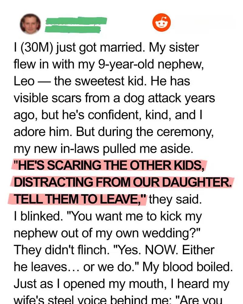 My In-Laws Tried to Ban My Scarred Nephew from Our Wedding — My Wife’s Response Left Them Speechless