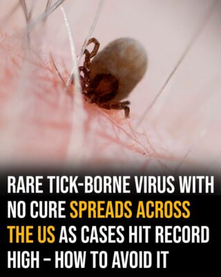 Rare tick-borne virus with no cure spreads across the US as cases hit record high – how to avoid it